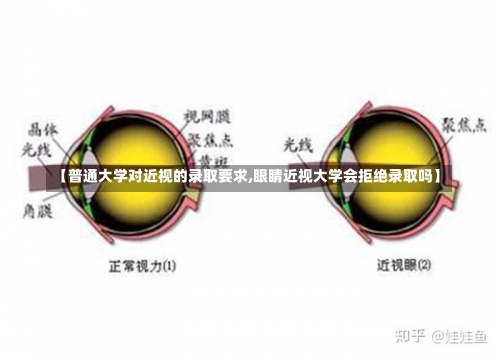 【普通大学对近视的录取要求,眼睛近视大学会拒绝录取吗】